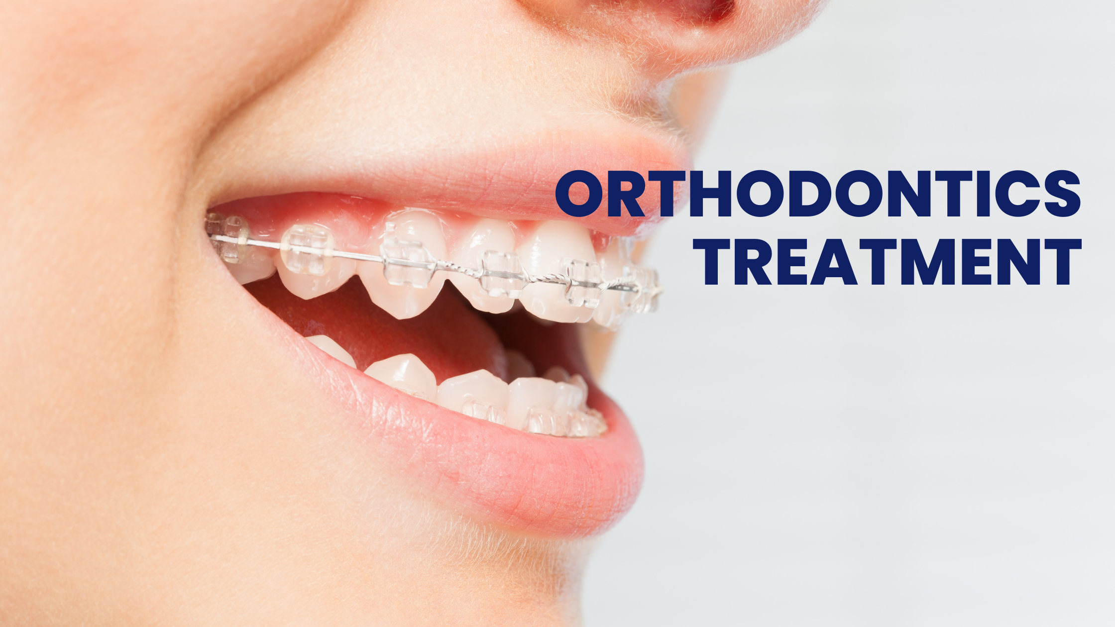 Unveiling the Magic of Orthodontics Treatment