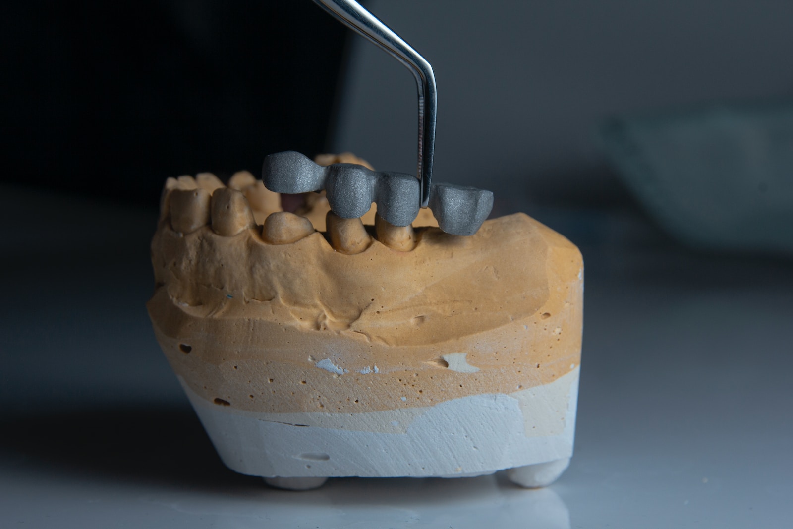 a model of a tooth- Dental Crown