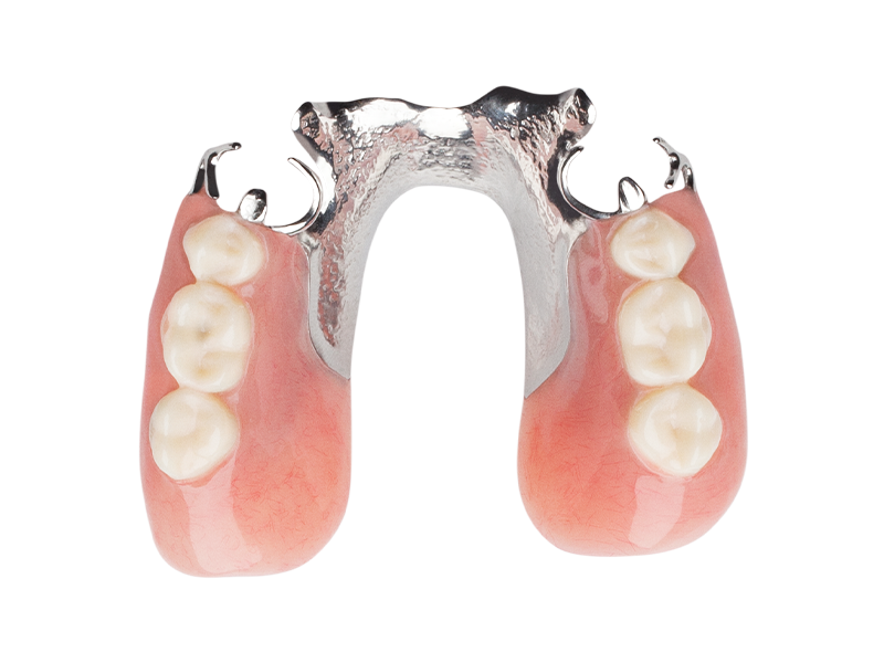 Partial Chrome Dentures