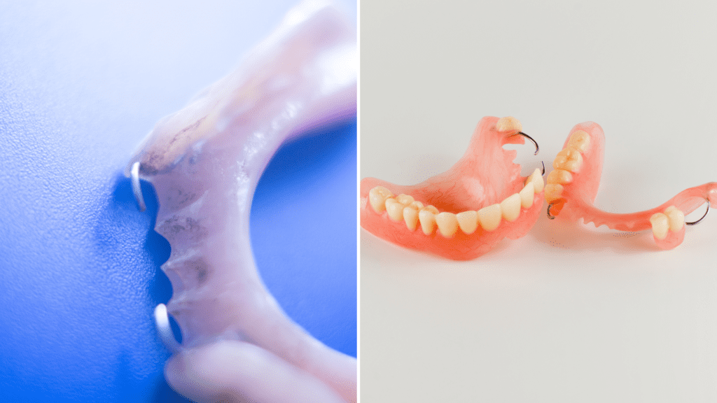 Partial Chrome Dentures