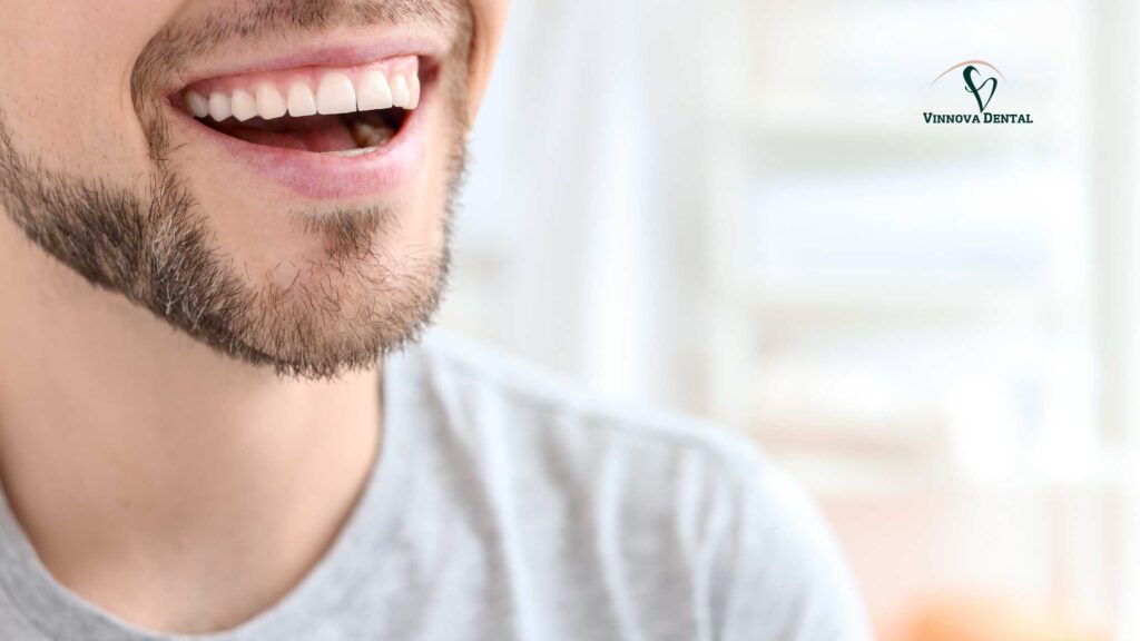 Professional Teeth Whitening in Albury