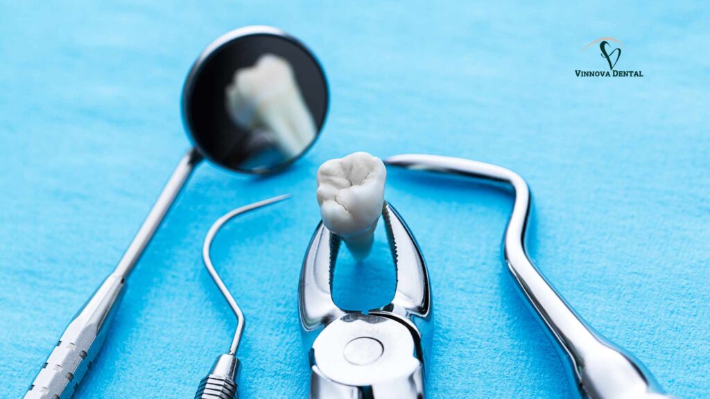 Tooth Extraction