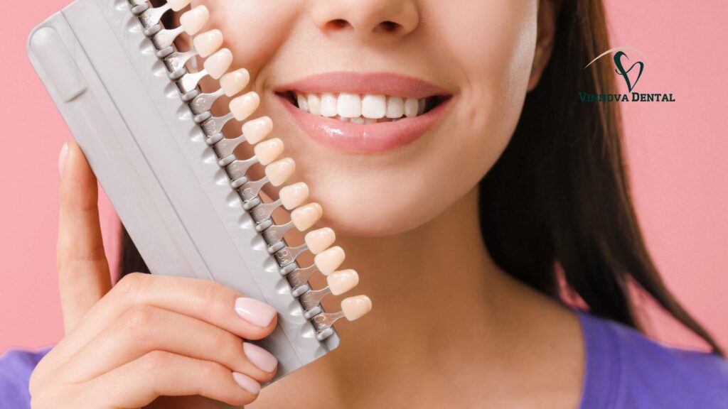 Porcelain Veneers