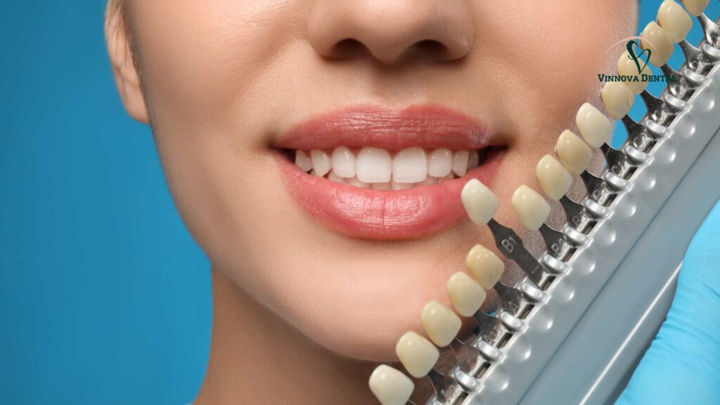 Cosmetic Dentists in Wodonga