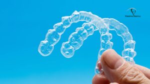 Invisalign Before and After