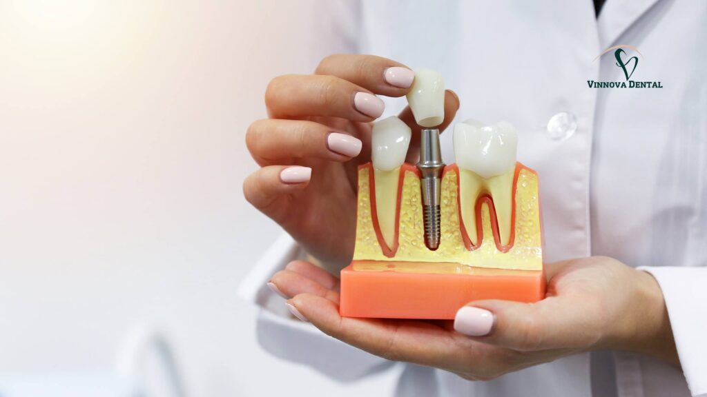 Implant Dentist Near Me