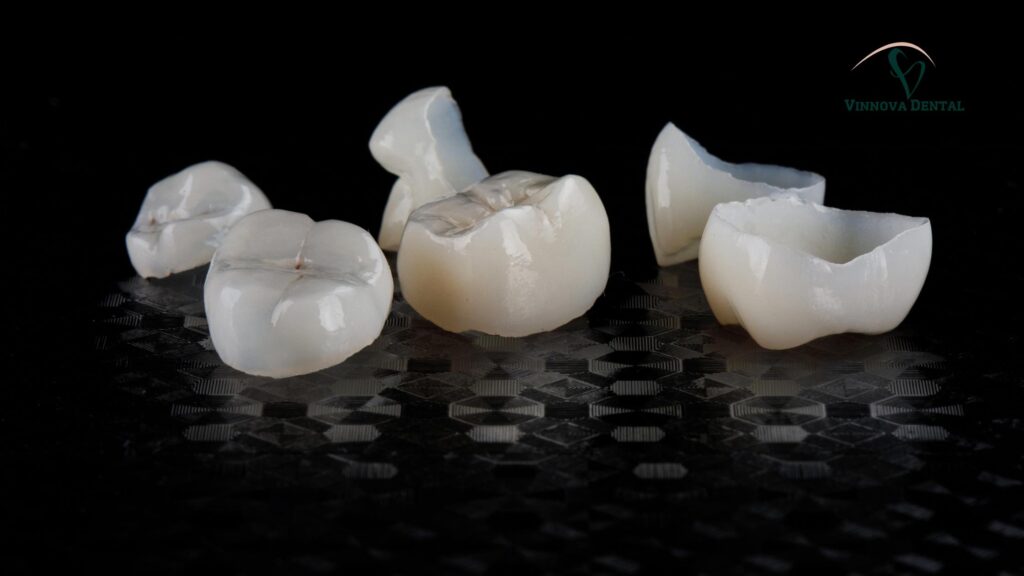 Caring for Your Crown to Avoid Replacement — How Proper Maintenance Affects Dental Crown Cost Over Time Dental Crown Cost