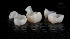 Dental Crown Cost