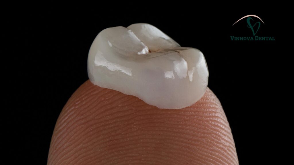 How Long Does a Crown Last and How It Affects Future Dental Crown Cost Dental Crown Cost