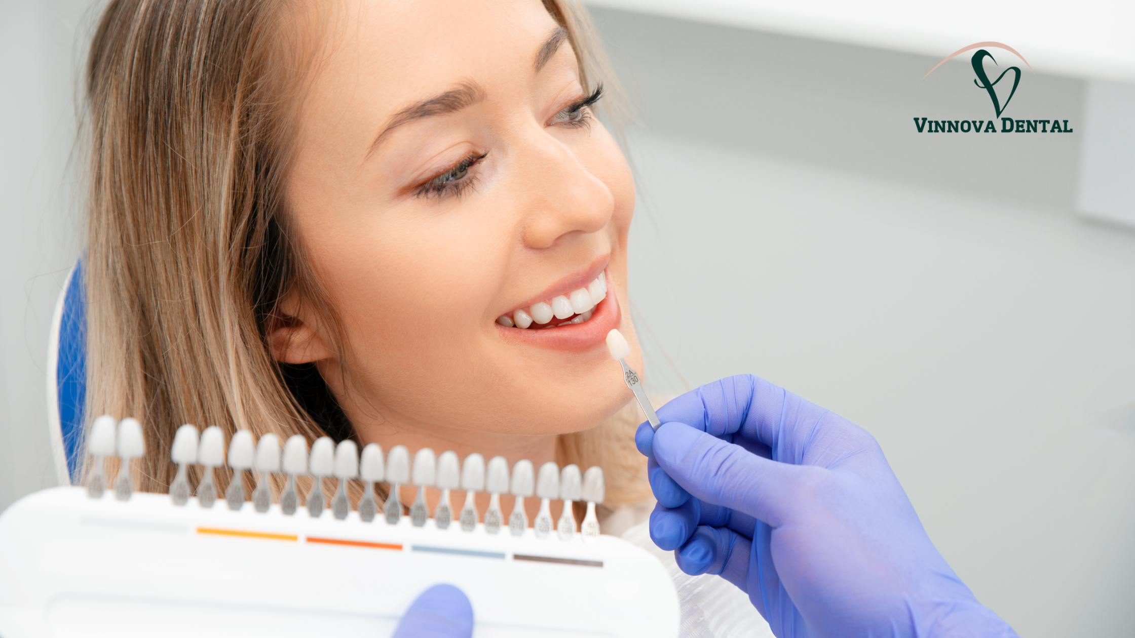 Veneers