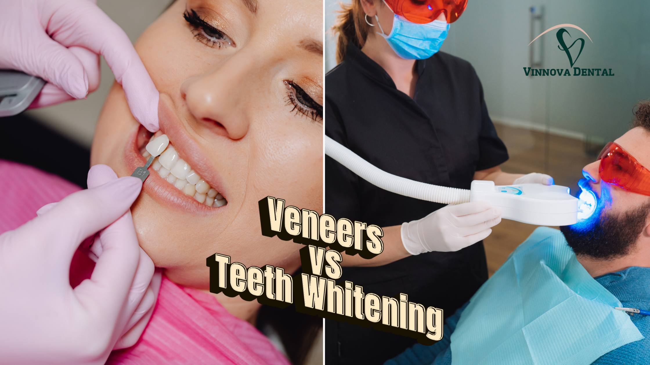 Veneers vs Teeth Whitening