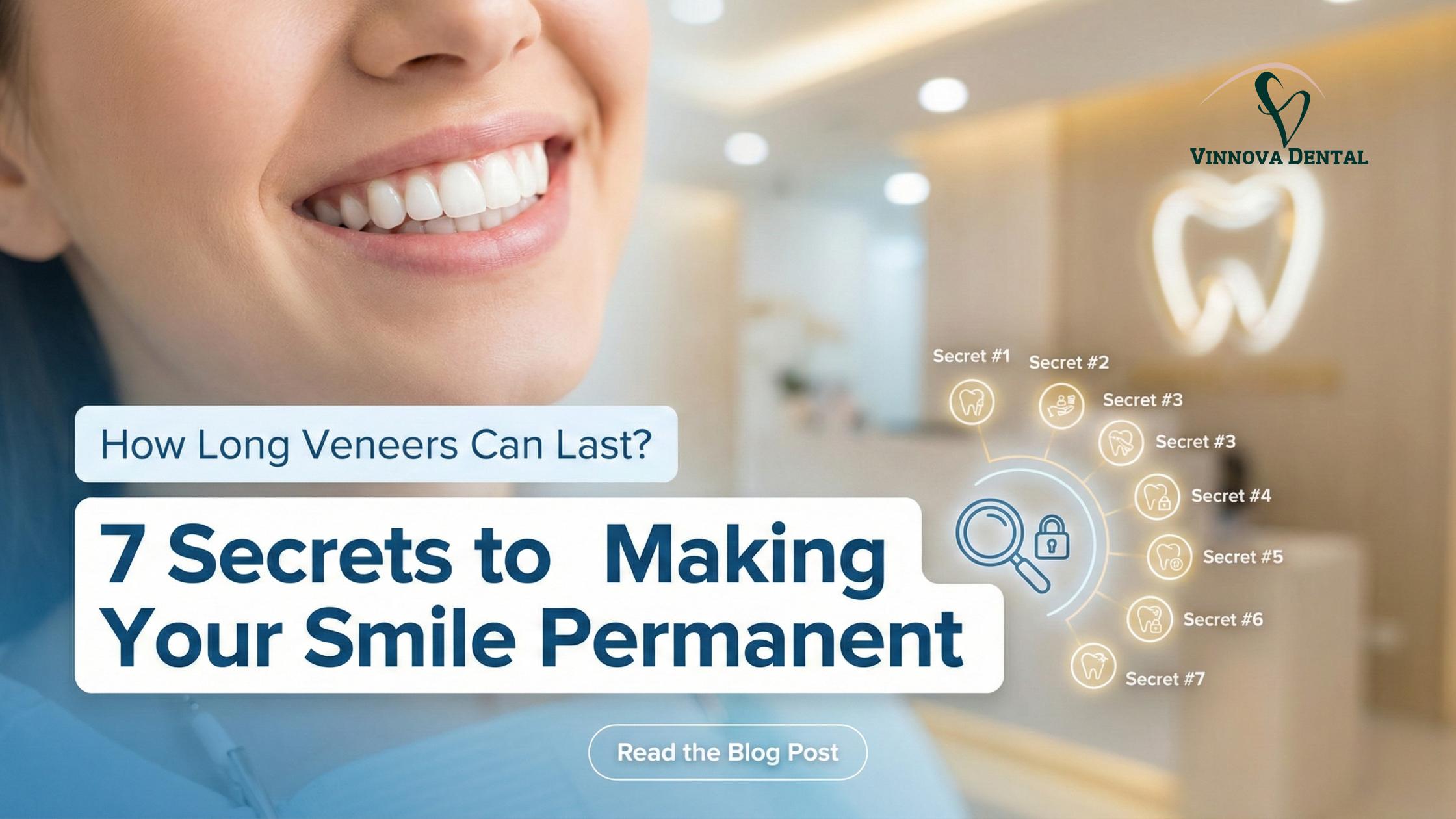 Veneers Can Last